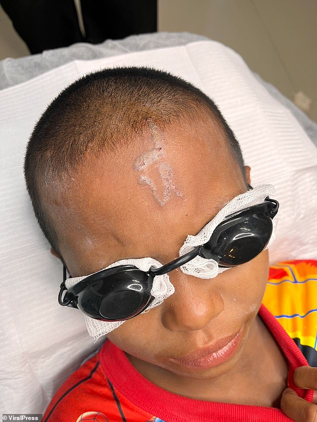 Tattoo Artist Janjira Kaewket Removes Offensive Ink from Young Thai Boy After Classmates Humiliate Him in Kanchanaburi