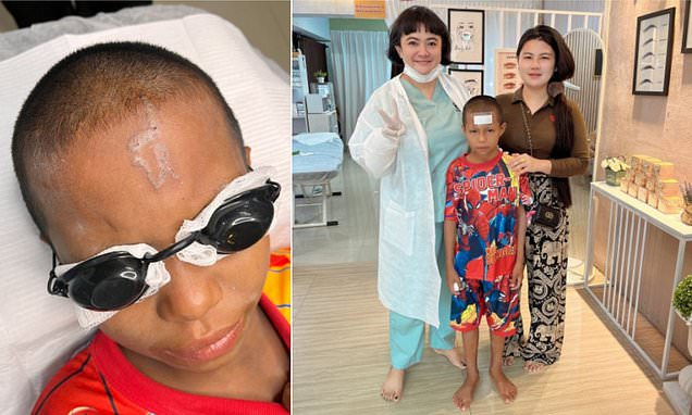 Tattoo artist in Thailand rescues bullied schoolboy by removing cruel slur tattooed on his forehead after classmates’ vicious prank in Kanchanaburi province